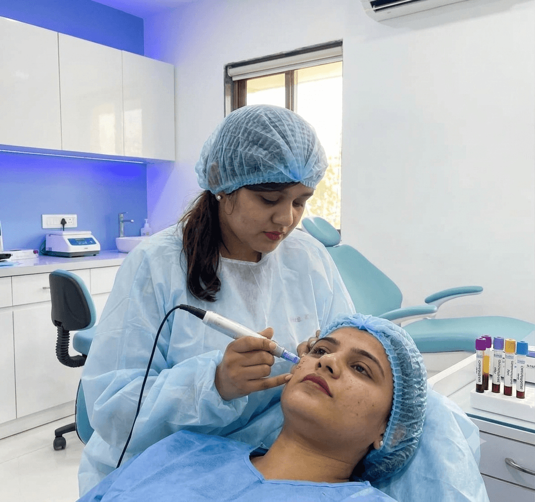 PRP With Microneedling