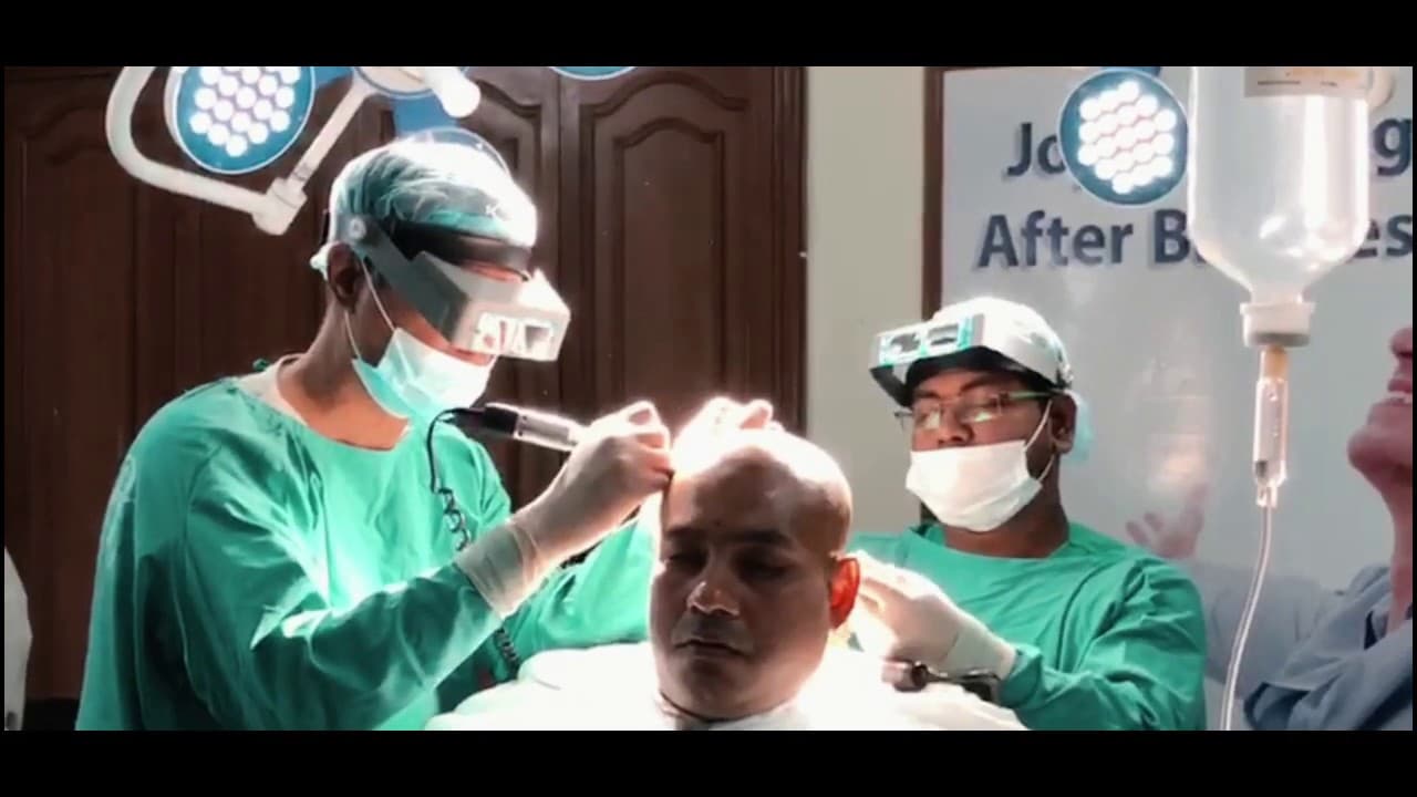 FUE Hair Transplant Surgery